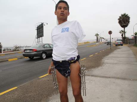 La Emotiva Historia Del Colombiano Sin Brazo Y Con Fierros En Sus