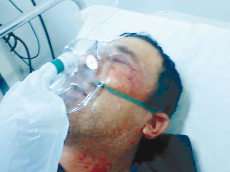 Familia de pescador golpeado por Carabineros en Antofagasta iniciará acciones legales