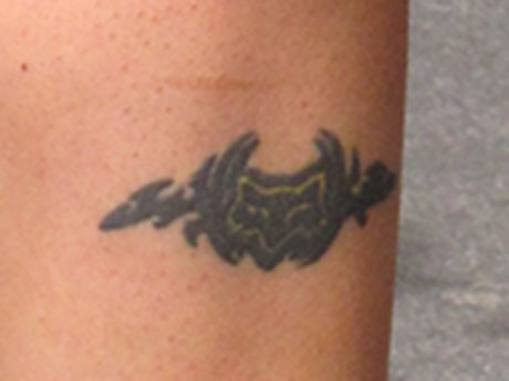 La alcaldesa de Antofagasta Karen Rojo pretende borrarse su enigmático tatuaje