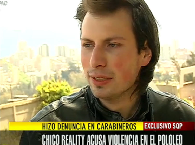 Ex participante de “Mundos Opuestos 2” denunció a su ex polola por violencia Ex participante de “Mundos Opuestos 2” denunció a su ex polola por violencia