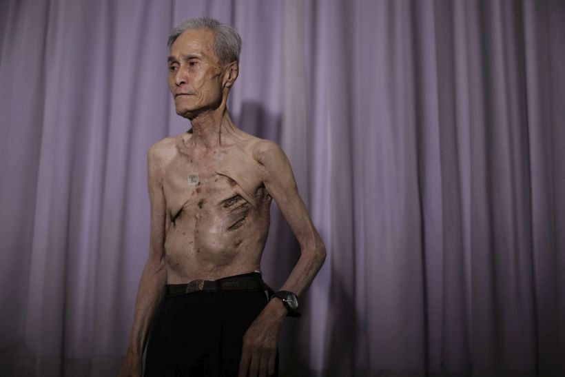 Las impactantes fotos de un sobreviviente de la bomba atómica de Nagasaki