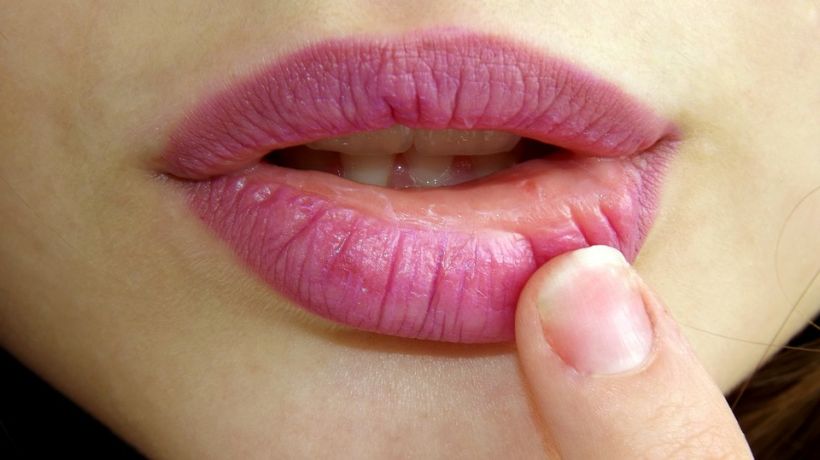 Post verano: seis consejos para lucir los labios hidratados