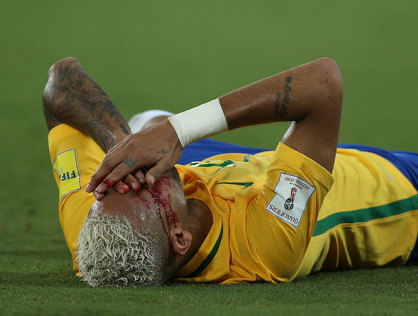 Neymar trató de hacer un lujito ante Bolivia y terminó sangrando