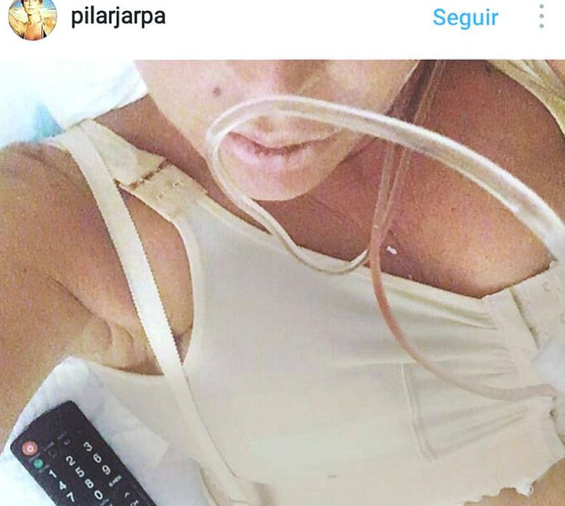 Pilar Jarpa se sacó los implantes y aprovechó de hacerse tres cirugías más