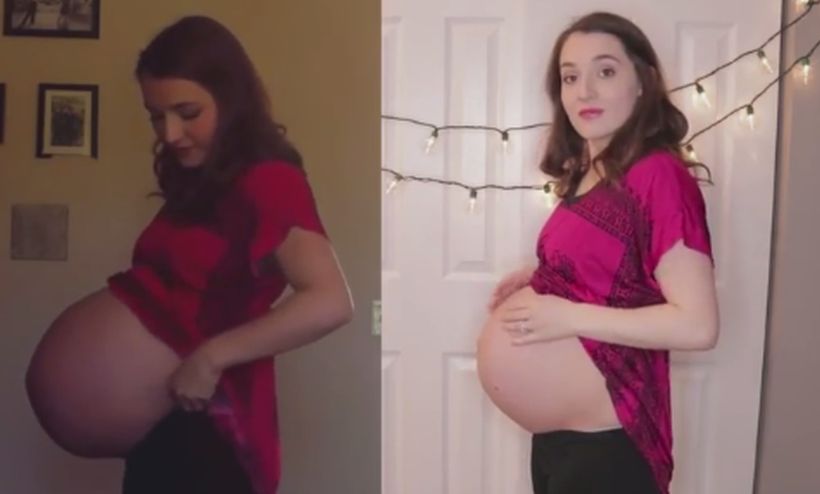 Mujer mostró la diferencia de su panza con un embarazo de una guagua y otro de gemelos