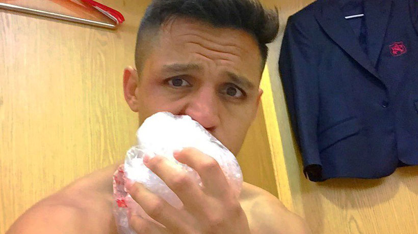 Ex campeón del mundo de rugby trolleó a Alexis Sánchez por su labio hinchado