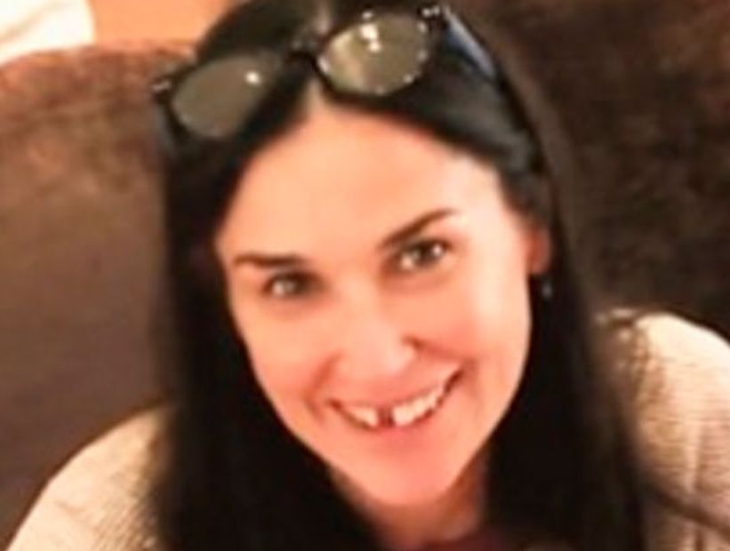 Demi Moore perdió dos dientes por culpa del estrés