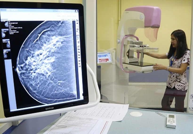 Gobierno llamó a usar el permiso laboral para realizarse exámenes preventivos del cáncer de mama