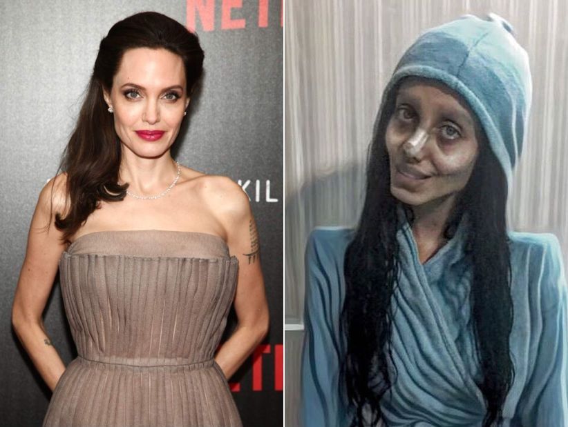 [FOTOS] Una joven iraní se sometió a 50 operaciones para parecerse a Angelina Jolie