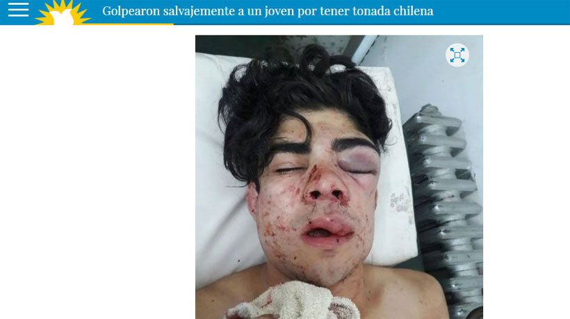 Argentina: detuvieron a los atacantes que desfiguraron a un joven por su acento chileno