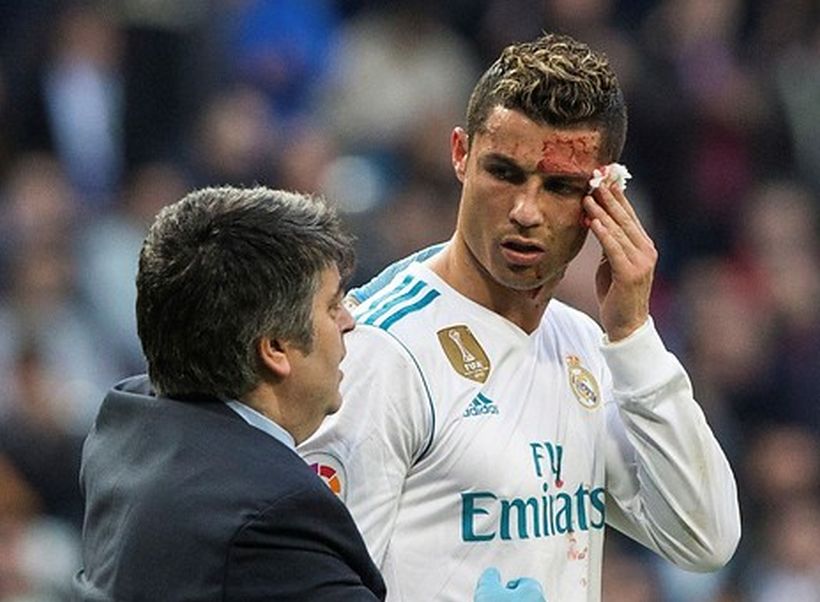 Cristiano Ronaldo tras su golpe en el ojo: 