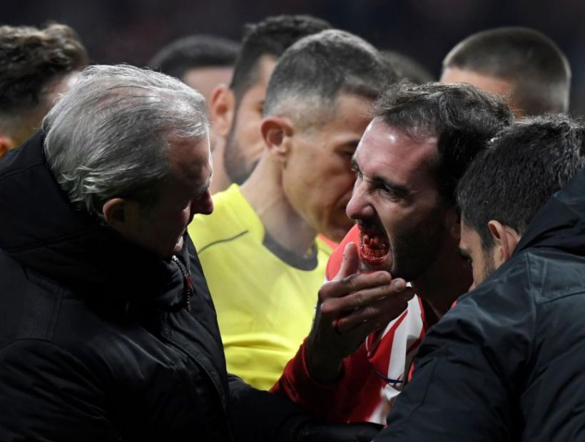 Diego Godín no jugará ante el Málaga tras perder tres dientes