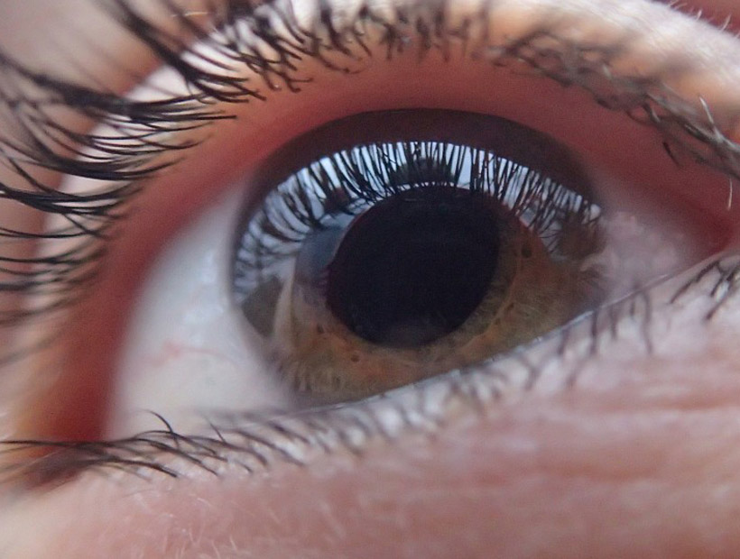 Las claves del glaucoma, la enfermedad silenciosa que puede provocar la pérdida de la visión