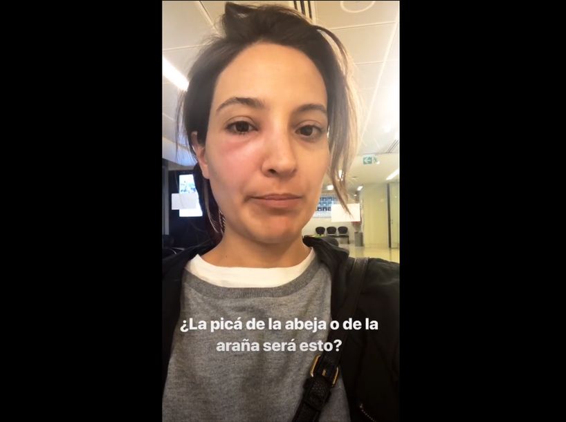 La mala suerte de Daniela Palavecino: la picó una abeja mientras hacía un meme