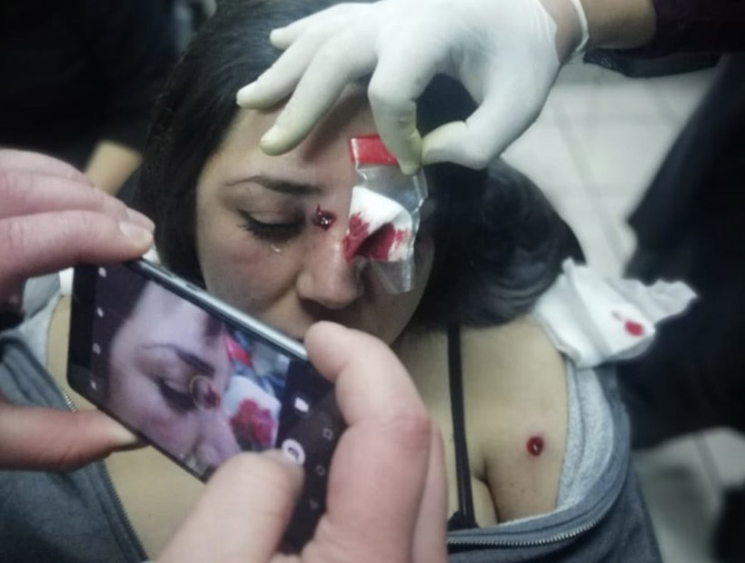 Carabineros revisará protocolo de actuación tras denuncia de alumna de la U. Iberoamericana herida con perdigones