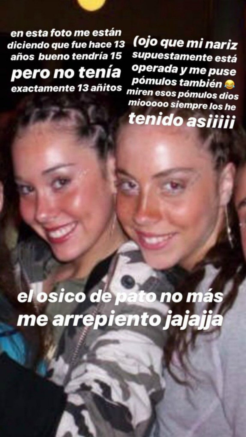 Vale Roth publicó fotografía del pasado para probar que no se habría hecho cirugías plásticas