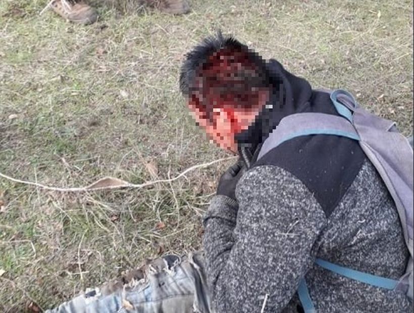 Cuatro carabineros lesionados y un comunero herido en la cabeza tras operativo policial en Victoria Cuatro carabineros lesionados y un comunero herido en la cabeza tras operativo policial en Victoria