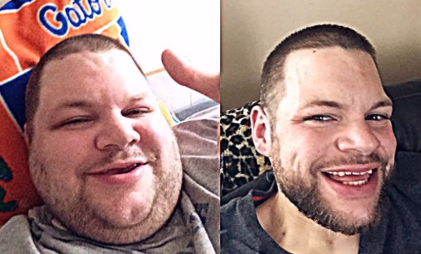 Obesos morbidos antes y despues de adelgazar