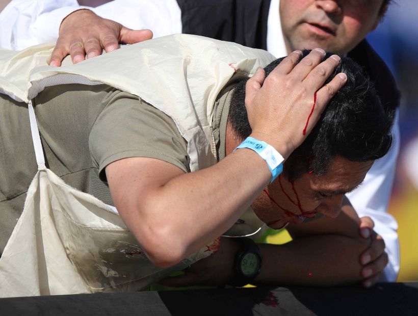 Superclásico: Fotógrafo de Colo Colo fue herido en la cabeza por un proyectil