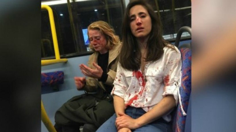 Detienen a sospechosos de ataque lesbofóbico abordo de un autobús
