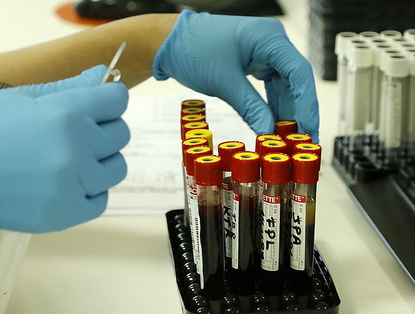 Científicos británicos pagarán casi $4 millones a voluntarios que se infecten con coronavirus
