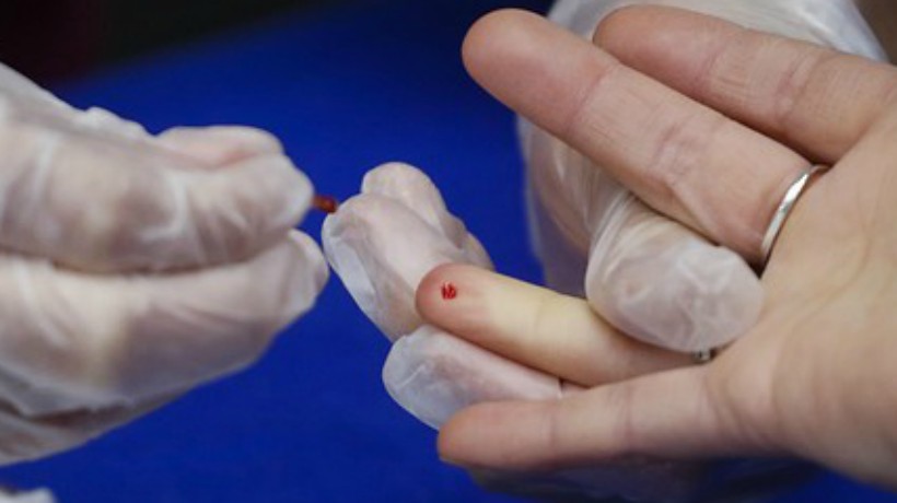 Confirman segundo caso mundial de cura del VIH