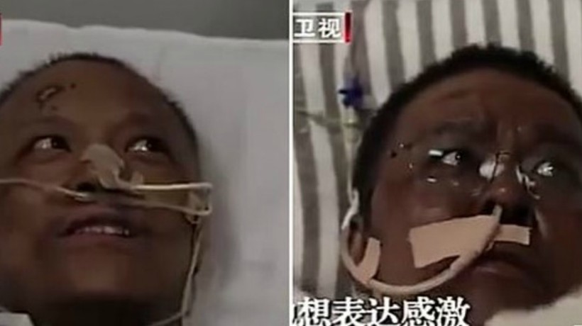 Falleció por coronavirus médico chino que experimentó cambios en el color de su piel