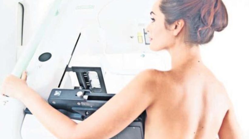 Entre un 70 y un 80% de las mujeres habría dejado de hacerse la mamografía por la pandemia