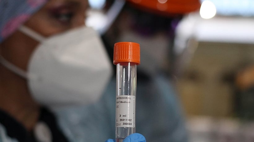 Informe Epidemiológico: 19.442 fallecidos en Chile por coronavirus