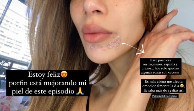 Foto Nota