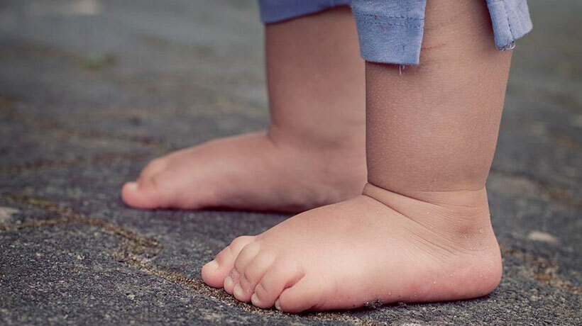 Llay Llay y Putaendo son de las 10 comunas del país con mayor riesgo de obesidad infantil