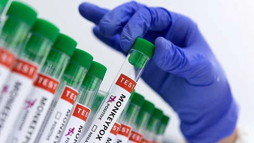 Ministerio de Salud declaró alerta sanitaria por casos de viruela del mono Ministerio de Salud declaró alerta sanitaria por casos de viruela del mono