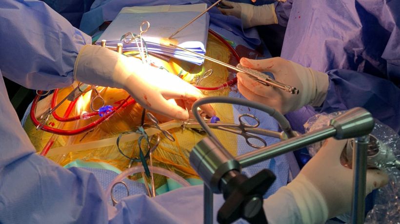 Realizan moderna cirugía cardíaca en el Hospital Las Higueras de Talcahuano