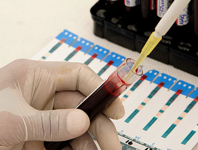 La sifilis es la infección de transmisión sexual con más prevalencia en el país