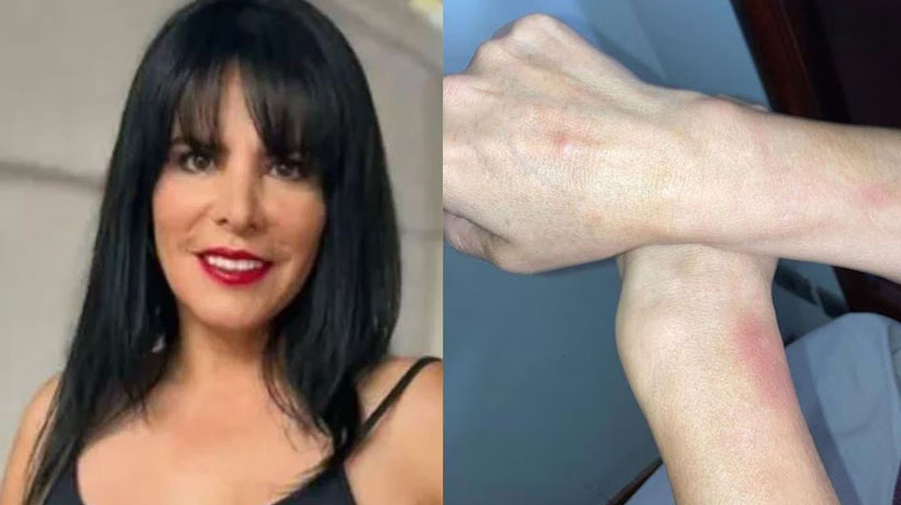 Anita Alvarado tras ser detenida por agredir a un oficial de la PDI: “Me trataron como una criminal”