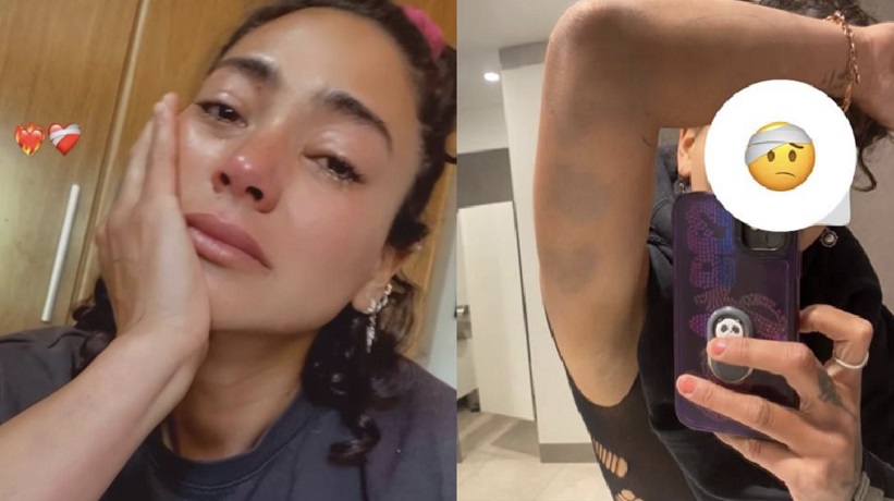 Camila Recabarren entregó nuevos detalles de agresión de su hermano: “La golpiza era totalmente evitable. No me pude defender”
