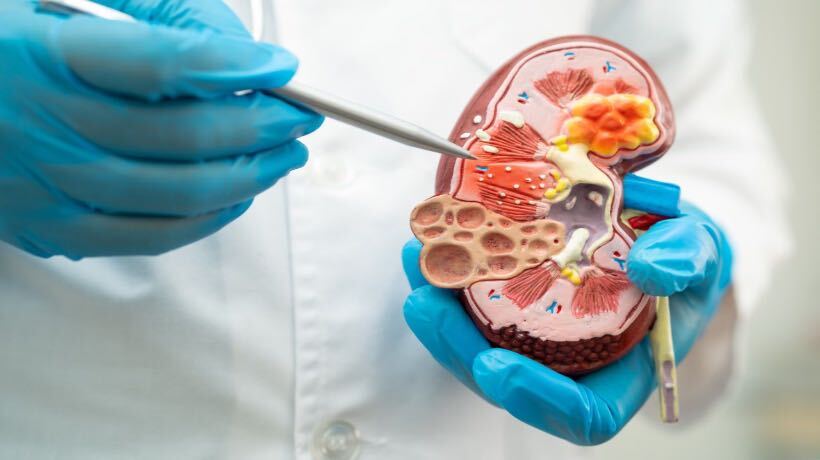 Nefrólogo del Hospital de Castro destaca la importancia de llevar un estilo de vida saludable para el cuidado del riñón Nefrólogo del Hospital de Castro destaca la importancia de llevar un estilo de vida saludable para el cuidado del riñón