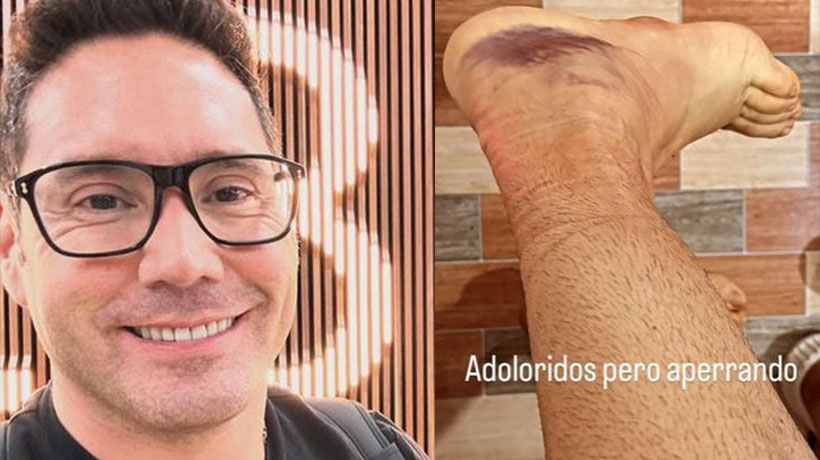 “Me saqué la chu…”: Pancho Saavedra revela lo primero que le dijo Jorge Zabaleta tras sufrir accidente en Filipinas