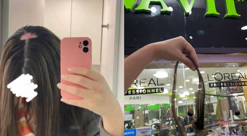 “El daño es irreversible”: el duro diagnóstico de joven que resultó con quemaduras en peluquería de Quilpué