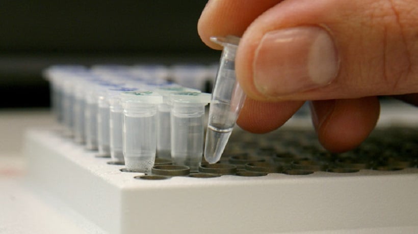 Comienza segunda fase de estudio pionero para detección del cáncer cérvico uterino en Antofagasta