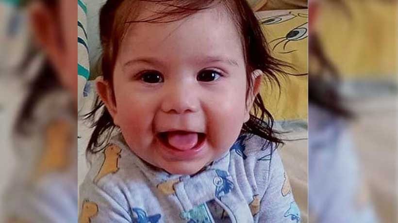 Santo Domingo: bebé de 9 meses necesita con urgencia operación a la columna