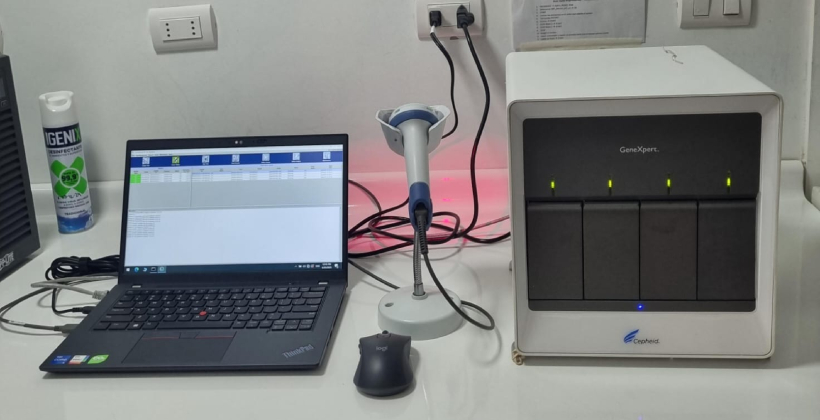Hospital de La Ligua incorpora tecnología de punta para detectar tuberculosis en 48 horas