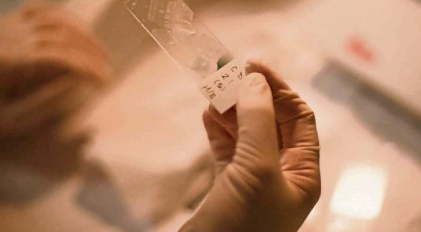 Chilenos desarrollan estrategia contra uno de los cánceres cerebrales más agresivos y letales