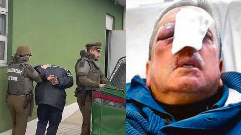 Detiene a dos sujetos de “entre 20 a 25 años” por brutal golpiza a conductor de micro en Villa Alemana