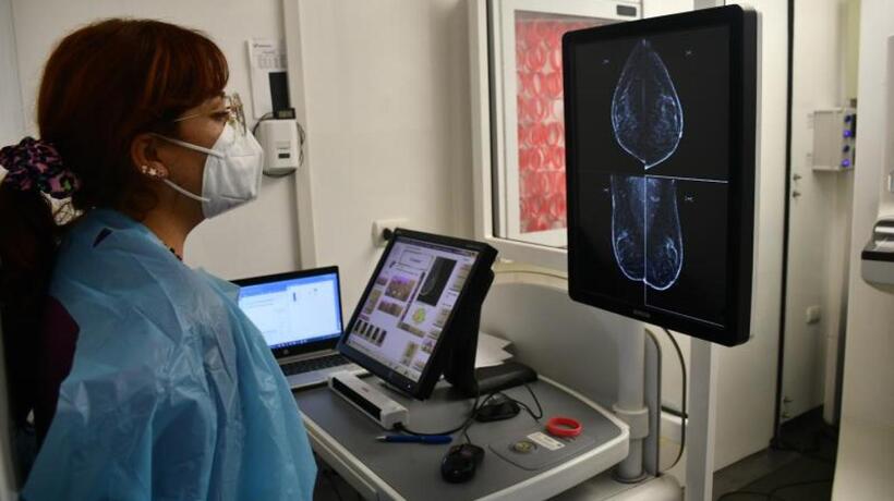 Más de 26 mil mujeres no tienen su mamografía al día en Temuco Más de 26 mil mujeres no tienen su mamografía al día en Temuco
