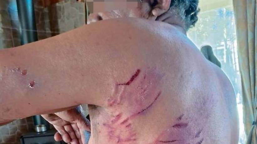 Pescador sufre feroz ataque de jauría en El Tabo Pescador sufre feroz ataque de jauría en El Tabo