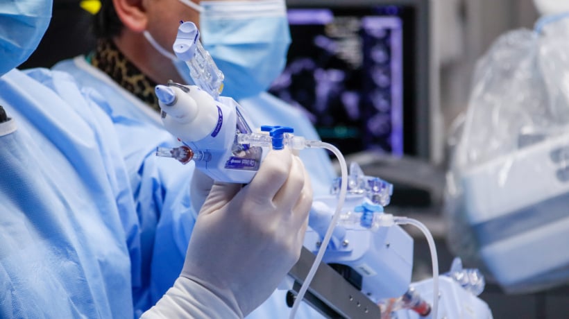 En el Hospital Regional de Concepción realizan inédita operación cardiaca: es la primera vez que se ejecuta en Chile En el Hospital Regional de Concepción realizan inédita operación cardiaca: es la primera vez que se ejecuta en Chile