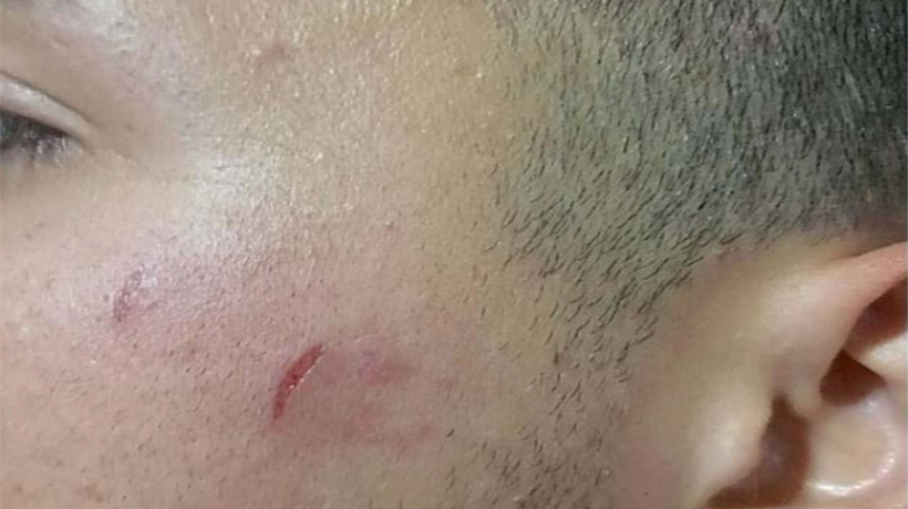 Universitario denunció que chofer lo bajó a golpes de bus Universitario denunció que chofer lo bajó a golpes de bus