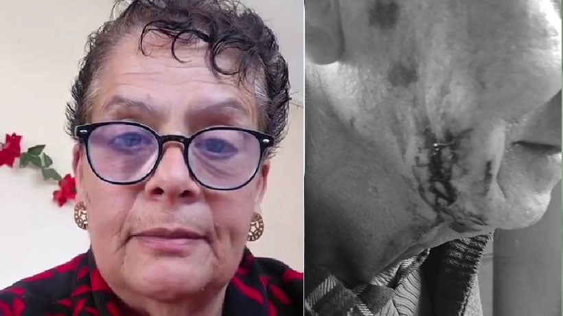 “Estamos en riesgo”: el desesperado llamado de madre para internar a su hijo de 34 años con TEA