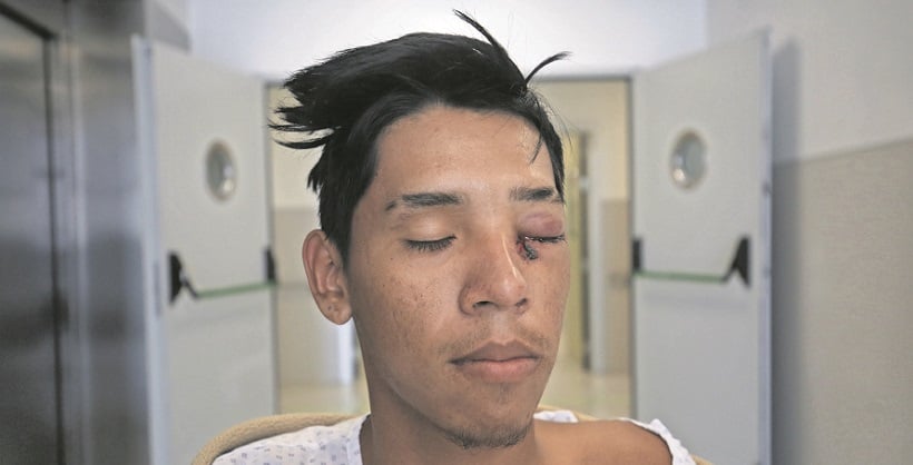 Madre del joven que perdió visión por perdigón y la indemnización de $150 millones: &quot;Eso no le va a comprar su ojo de vuelta&quot;